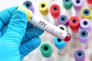 Estudo aponta que maioria dos diagnósticos tardios de HIV em Porto Alegre ocorre entre heterossexuais